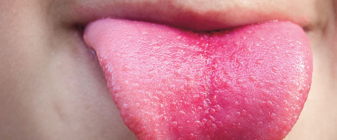 A close-up view of a human tongue extended from an open mouth, showing surface texture and taste buds